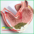 STOMACH04(12537) Human Stomach Model Gastric Disease Model for Medical Science Study